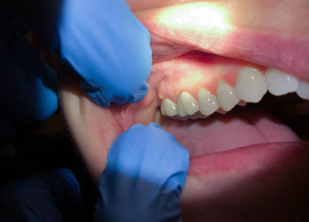 Best Emergency Tooth Extraction  in Lukachukai, AZ