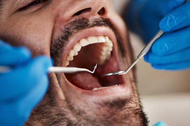 Best Urgent Tooth Repair  in Lukachukai, AZ